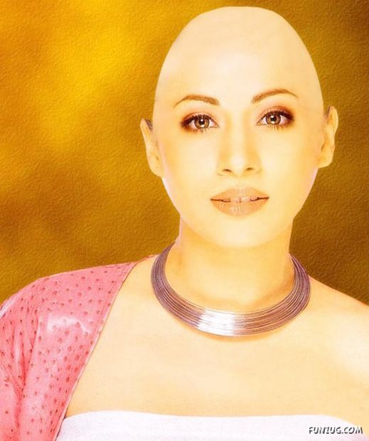 What If Your Favourite Celeb Go Bald? 