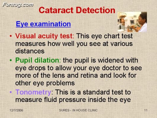 Very Useful Information on Cataract