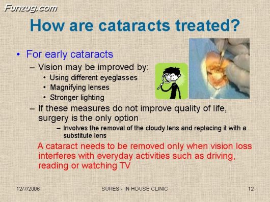 Very Useful Information on Cataract