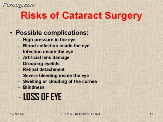 Very Useful Information on Cataract