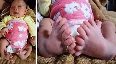 Weird Diseases That You Hardly Know