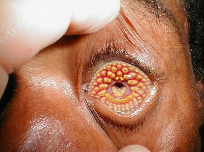 Weird Diseases That You Hardly Know