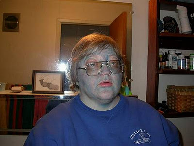 Weird Diseases That You Hardly Know