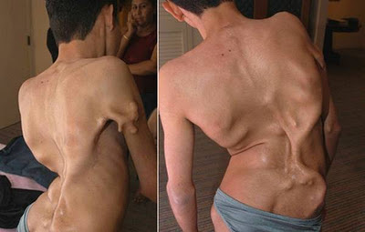 Weird Diseases That You Hardly Know